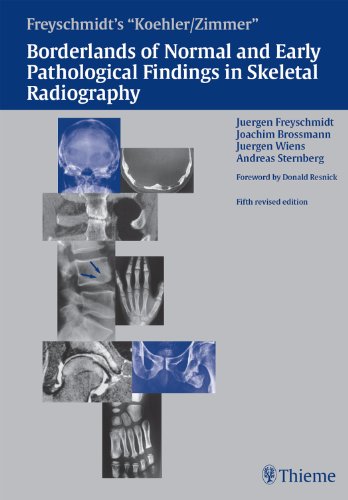 Borderlands of Normal and Early Pathologic Findings in Skeletal Radiography book cover