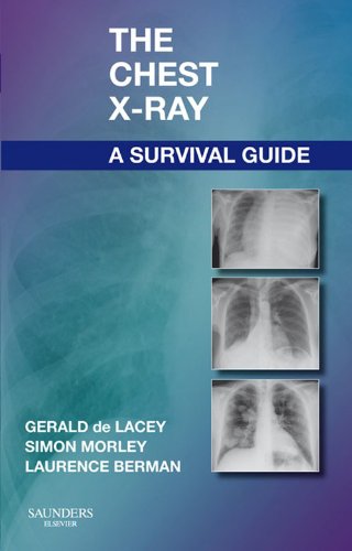 The Chest X-Ray: A Survival Guide book cover