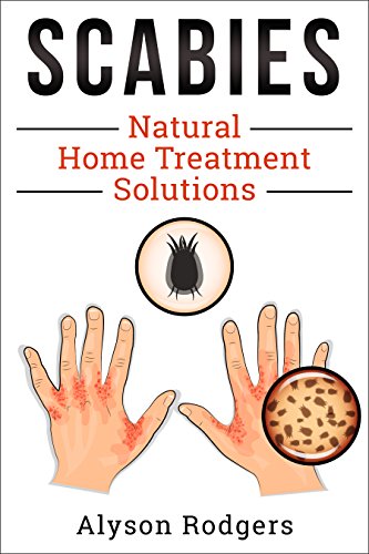 Scabies Natural Home Treatment Solution book cover