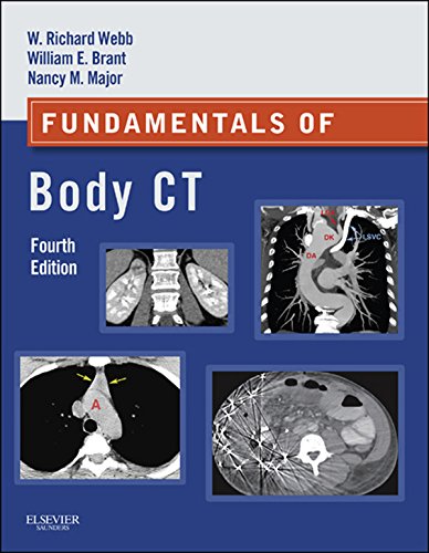 Fundamentals of Body CT book cover
