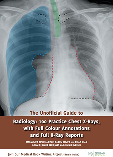 The Unofficial Guide to Radiology: 100 Practice Chest X Rays with Full Colour Annotations and Full X Ray Reports book cover