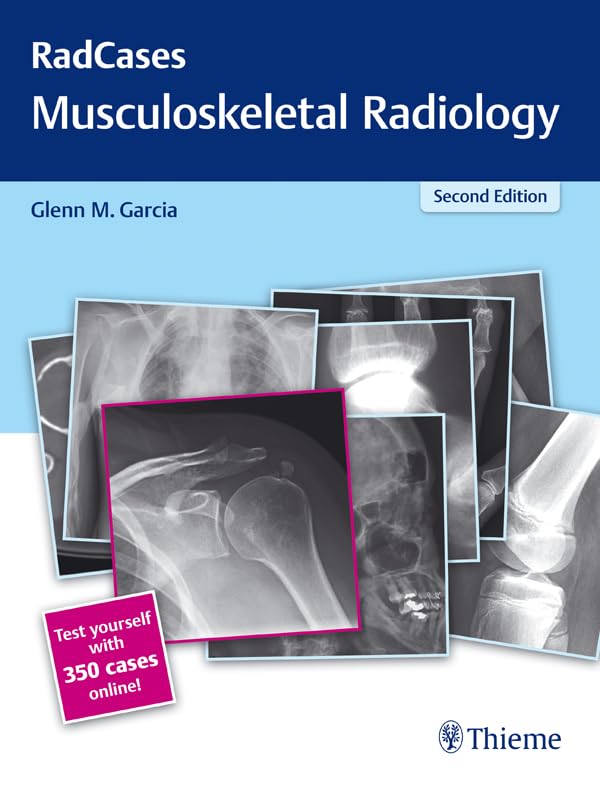 Radcases Musculoskeletal Radiology book cover