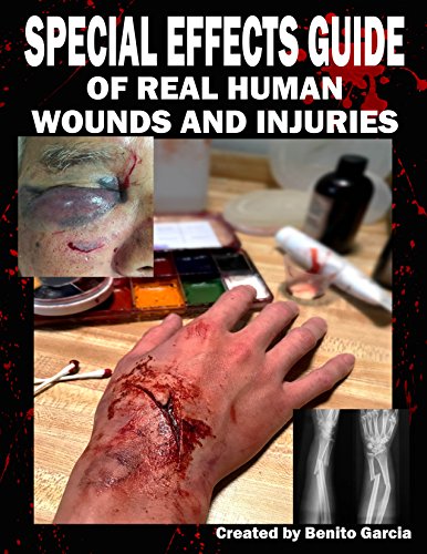 Special Effects Guide Of Real Human Wounds and Injuries: Special Effects Guide Of Real Human Wounds and Injuries book cover