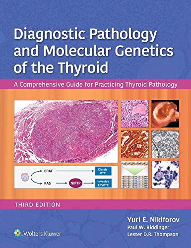 Molecular Surgical Pathology book cover