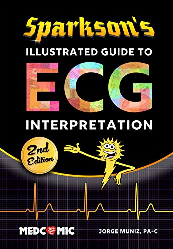 Sparkson's Illustrated Guide to ECG Interpretation, 2nd Edition book cover