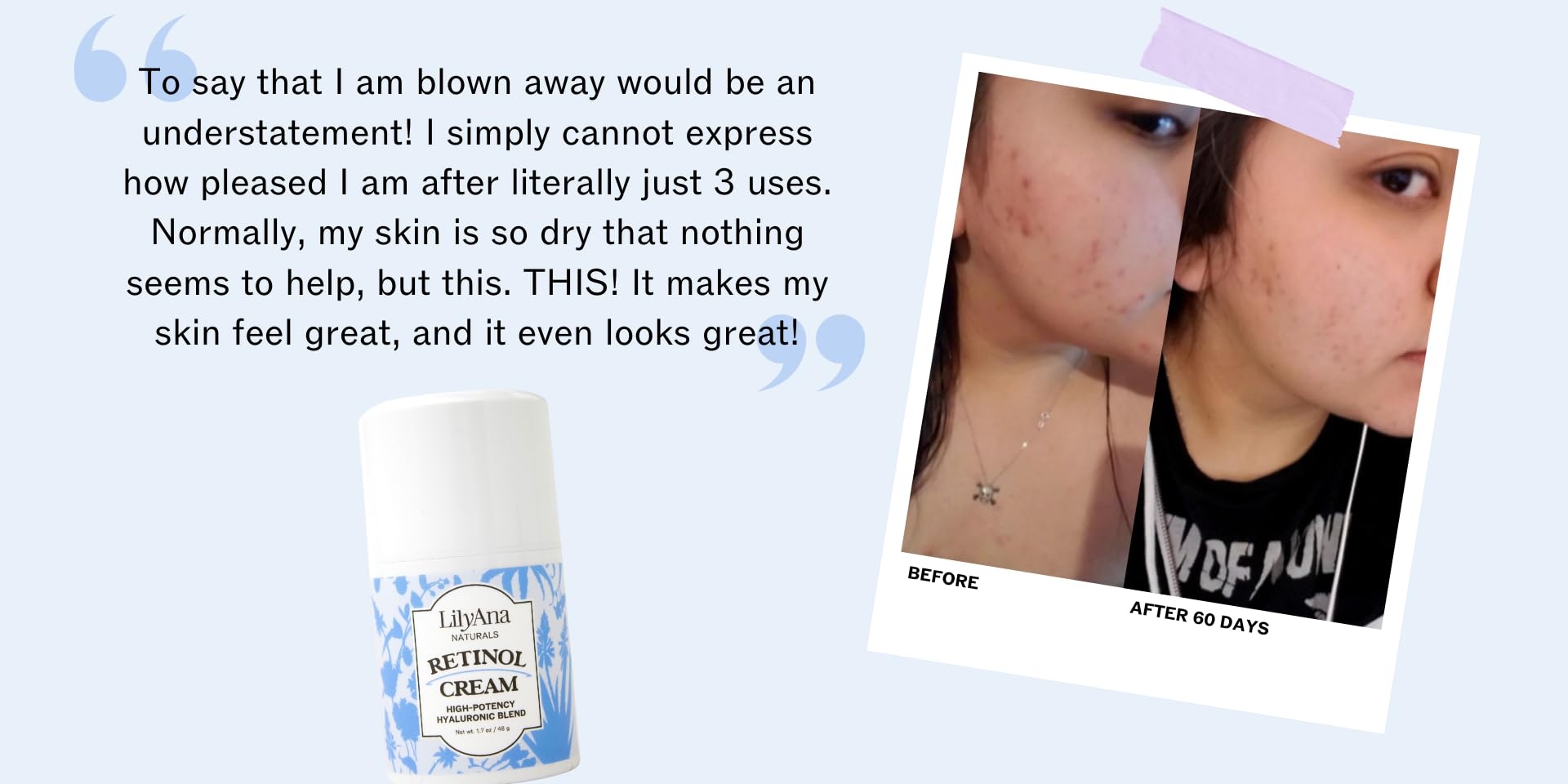 Amazon.com: LilyAna Naturals: Community