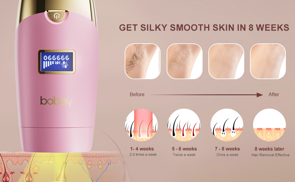 IPL Laser Hair Removal