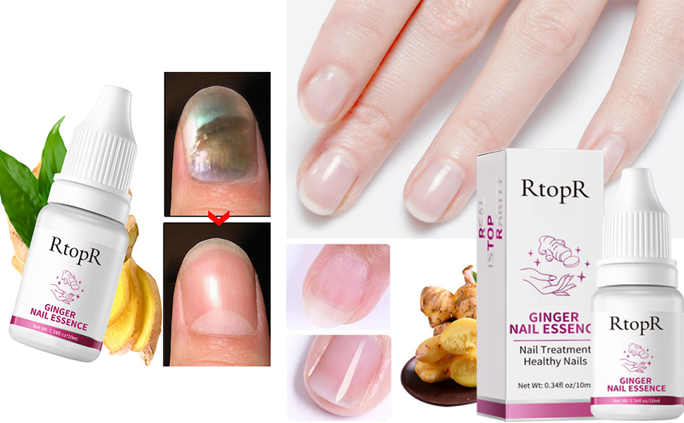 AKARY Ginger Nail Repair Essence, Effective Toenail