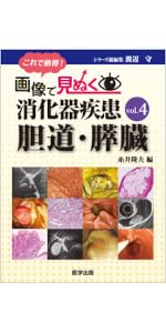 画像で見ぬく消化器疾患 vol.2 大腸 これで納得!画像で見ぬく消化器疾患 (vol.2) | 渡辺守 |本