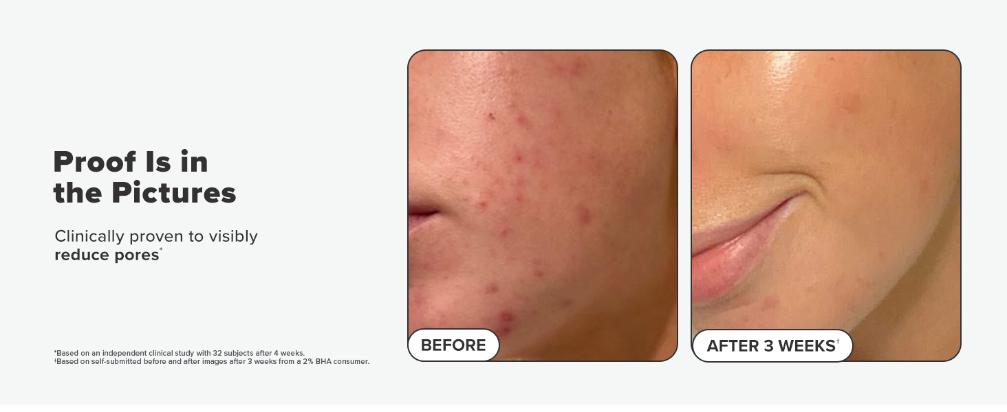 2% bha liquid exfoliant reduce pore