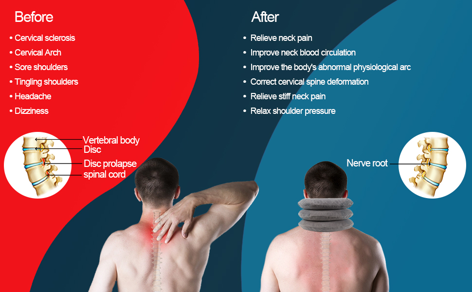 Cervical Neck Traction Device,Three Tube Quick Inflation