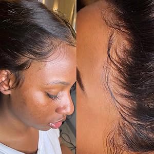 natural hairline