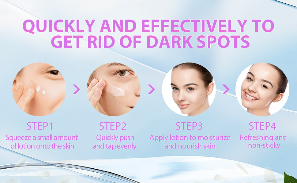 dark spot cream 