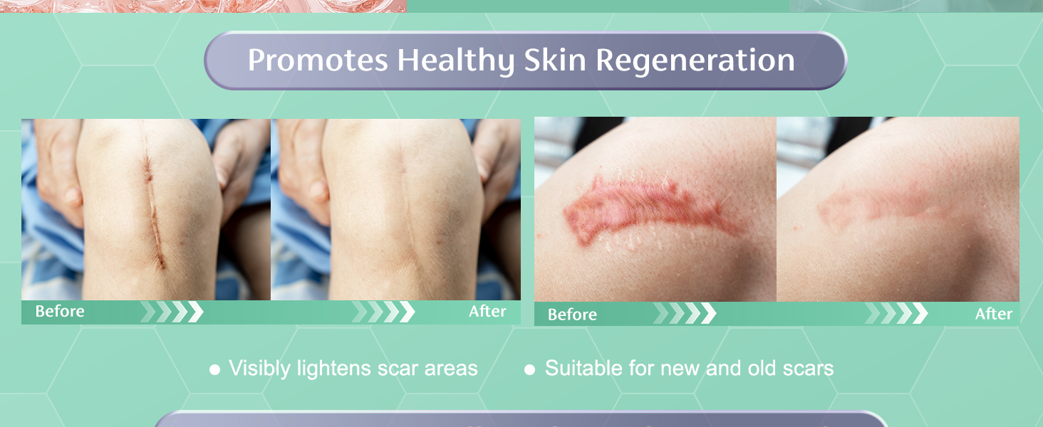 Continuous use will produce obvious results