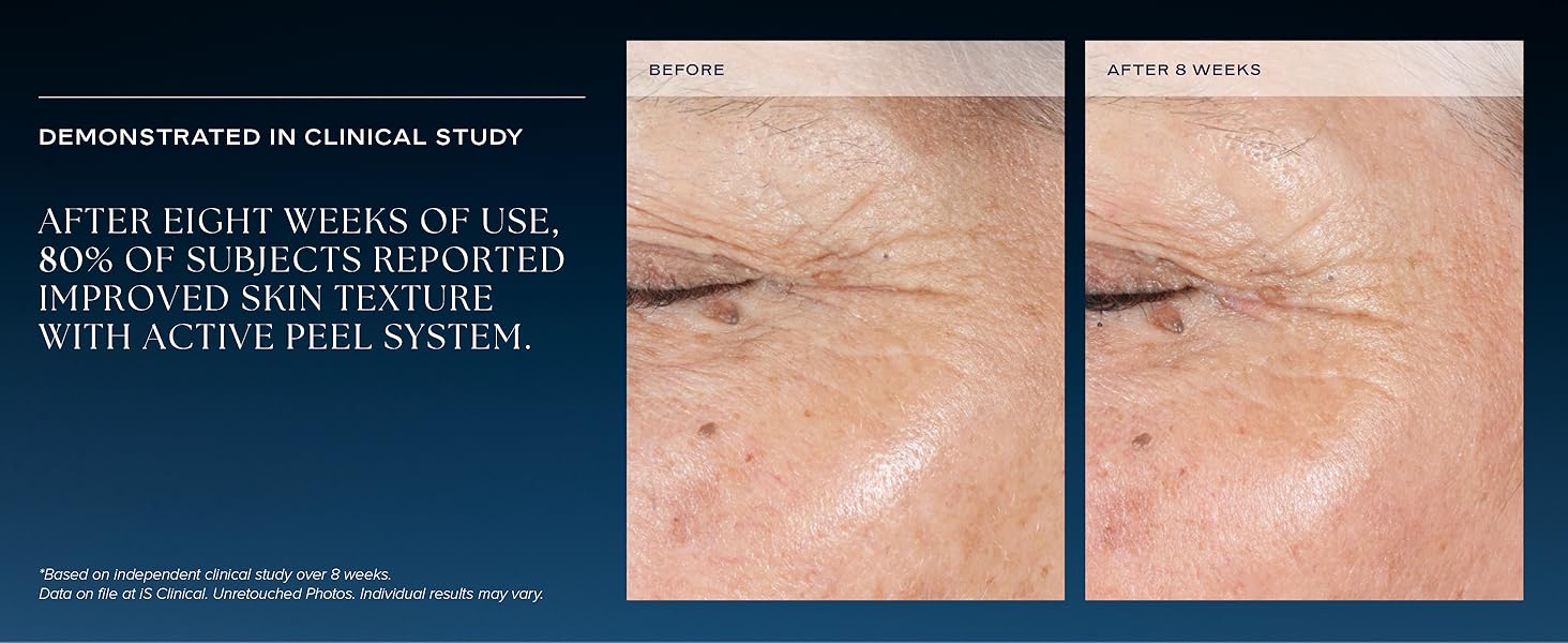 clinical study after 8 weeks 80% subjects reported improved skin texture