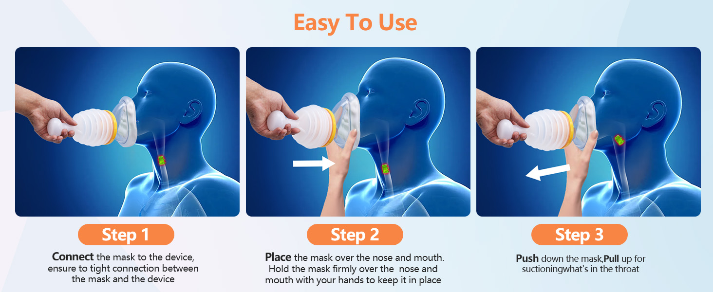 Anti Choking Device/Choking Rescue Device,Apparatus
