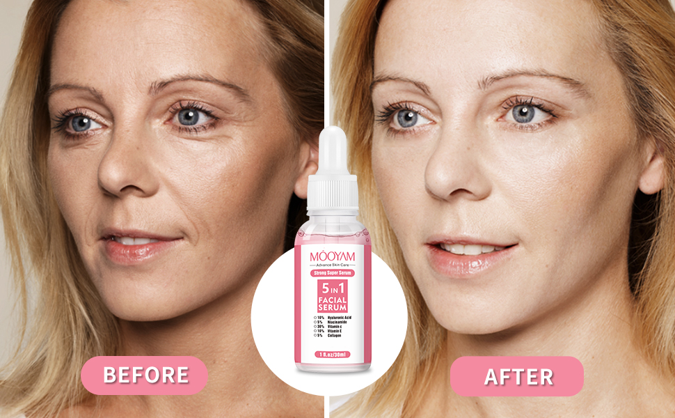 face serum