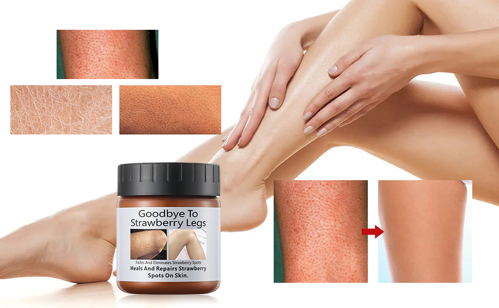 Strawberry Legs Treatment for Women