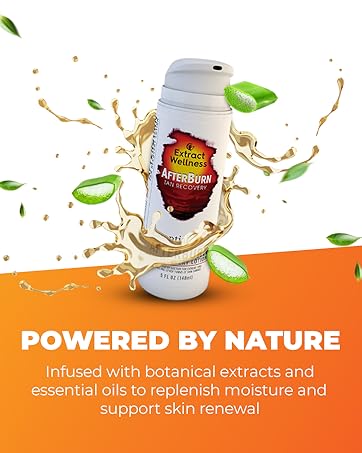 AfterBurn Recovery Lotion