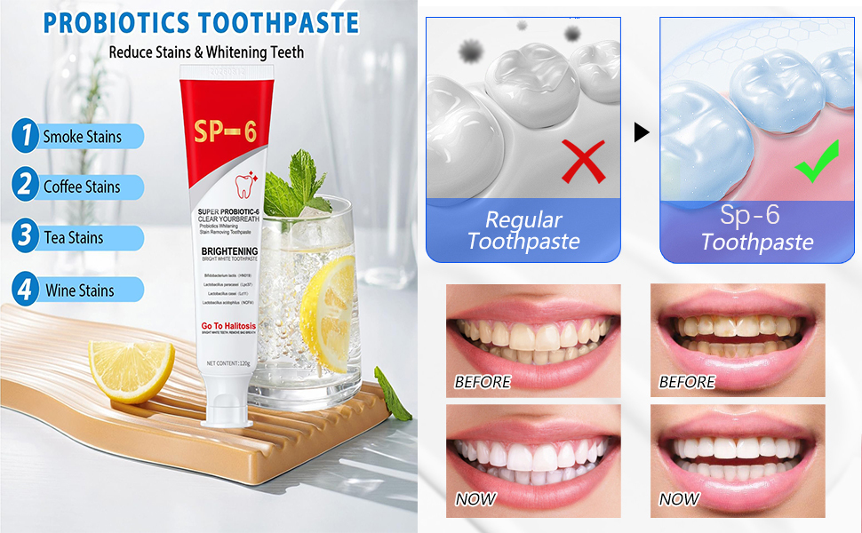 Sp-6 Ultra Whitening Toothpaste