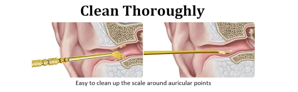 ear wax removal tool ear wax cleaner ear cleaning tool limpiador de oidos ear cleaner tool earwax 