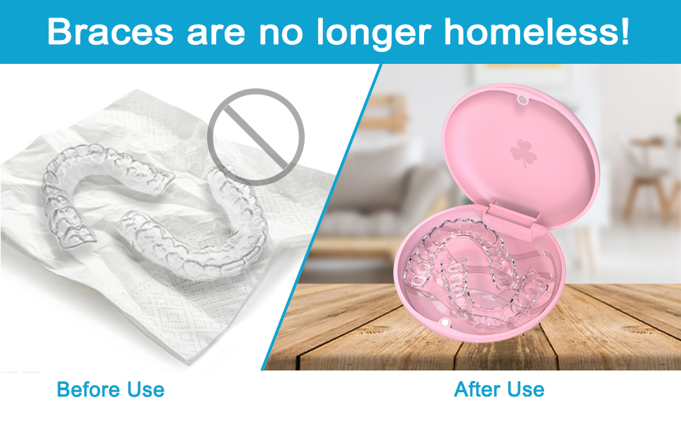 ARGOMAX 2 Pack Retainer Case, Aligner Case, Orthodontic