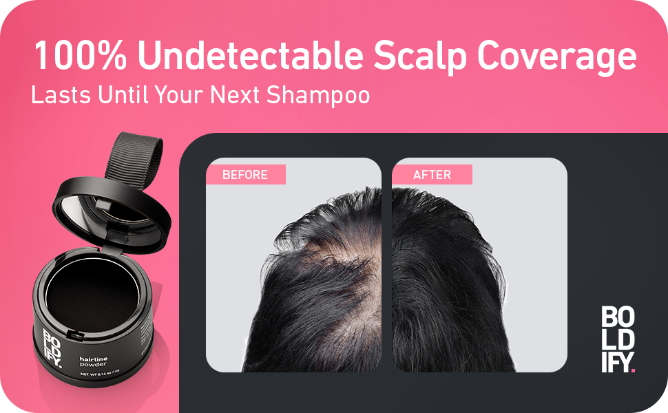BOLDIFY Hairline Powder, Instantly Conceals Hair Loss and Fills In Receding Hairlines, and Wide