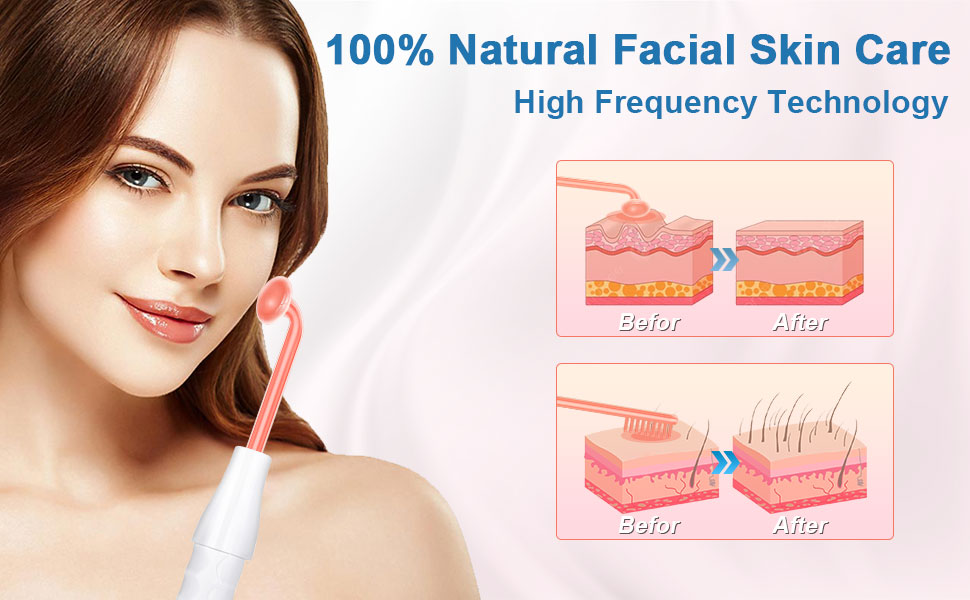 Yofuly High Frequency Wand, Portable High Frequency Facial Machine with 4 Red Electrodes, Skin