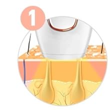 paso 1 de cómo funciona una depiladora láser ipl
