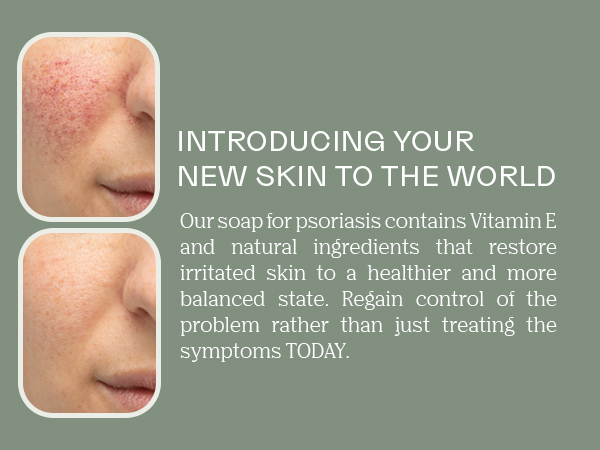 Black soap bar eczema Dead Sea coal tar acne mud adults bend basis sensitive skin