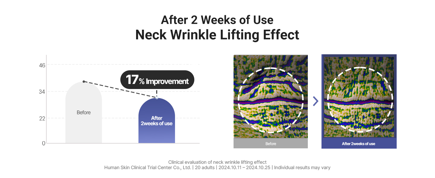 Neck Wrinkle Lifting Effect