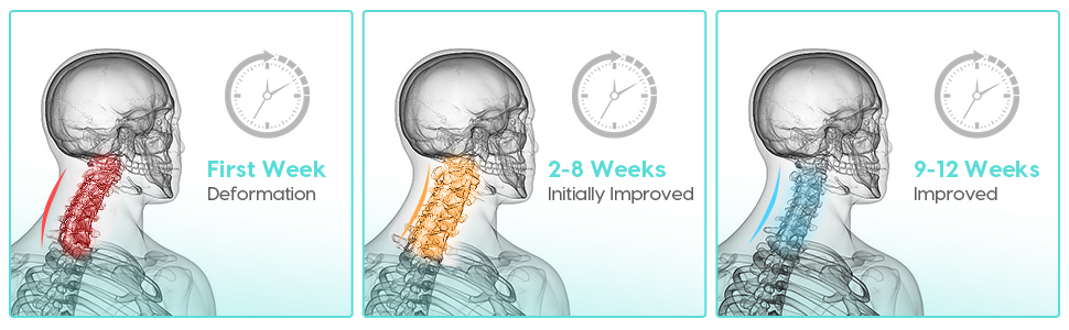 GOXIFACA Memory Foam Pillow, Cervical Pillow for Neck and Shoulder, Orthopedic Pillow, Ergonomic Neck Support Pillow for Side Back Stomach Sleepers with Removable Pillowcase, Grey 19 6