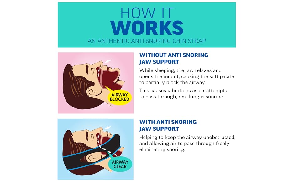Chin strap for sleeping for CPAP users anti-snoring stopper snoring devices double chin reducer 