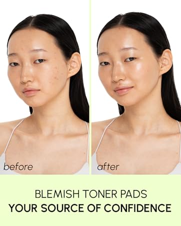 blemish toner pads 