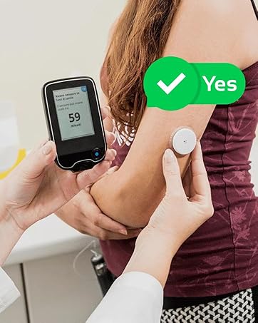 cgm