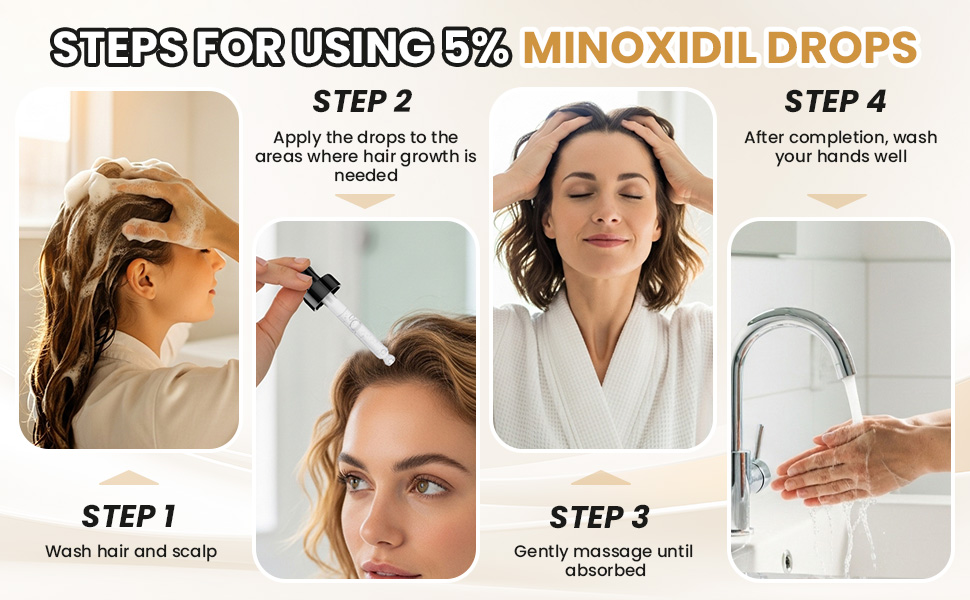 minoxidil women
