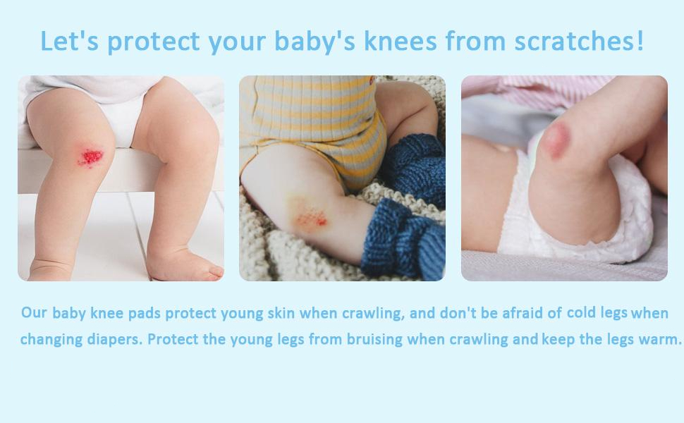 Knee Pads for Crawling Kids Crawling Knee Pads Anti-Slip Baby Knee Protectors