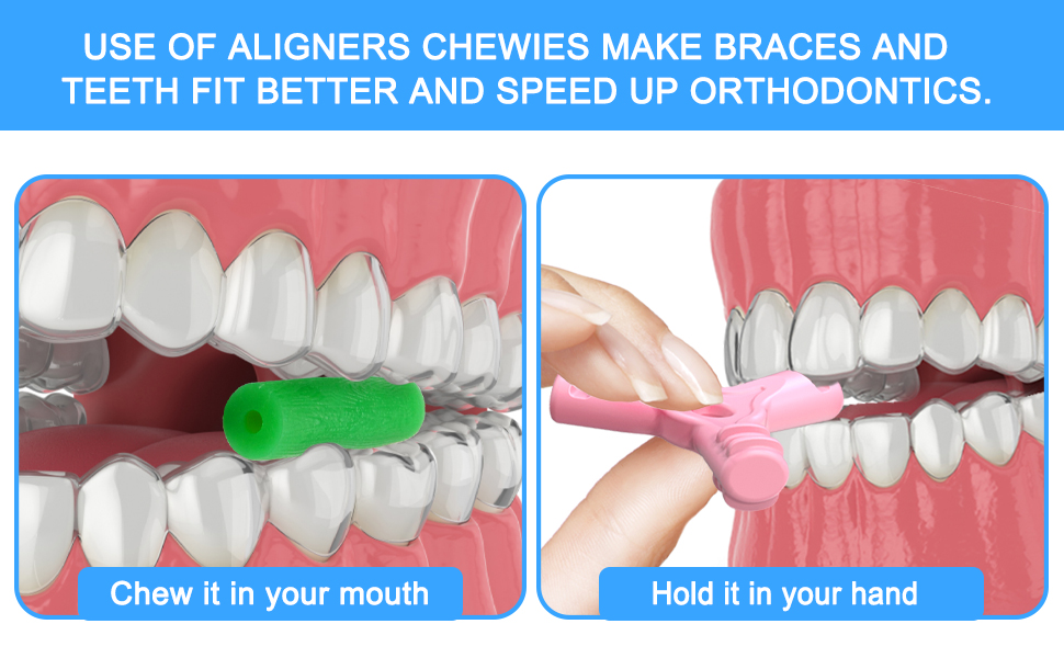 Y type aligner Chewies, Y shape tooth aligner Chewies, Y