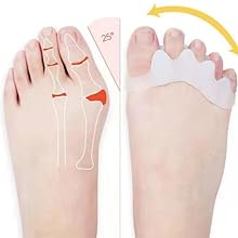 May correct toe up to 25 degrees