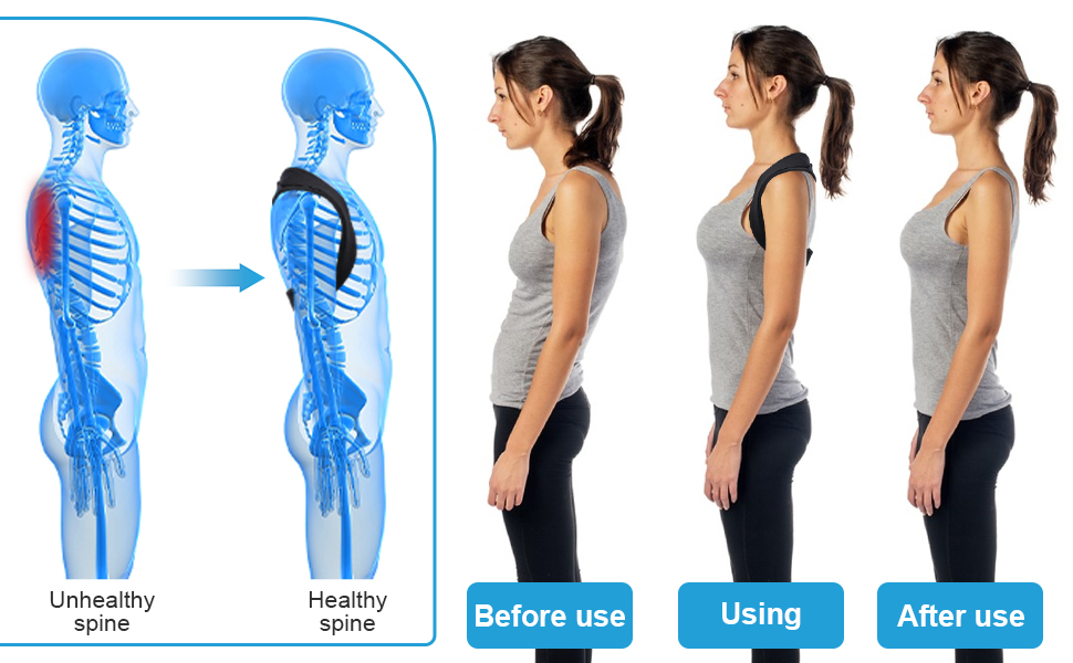 Back Brace Posture Corrector