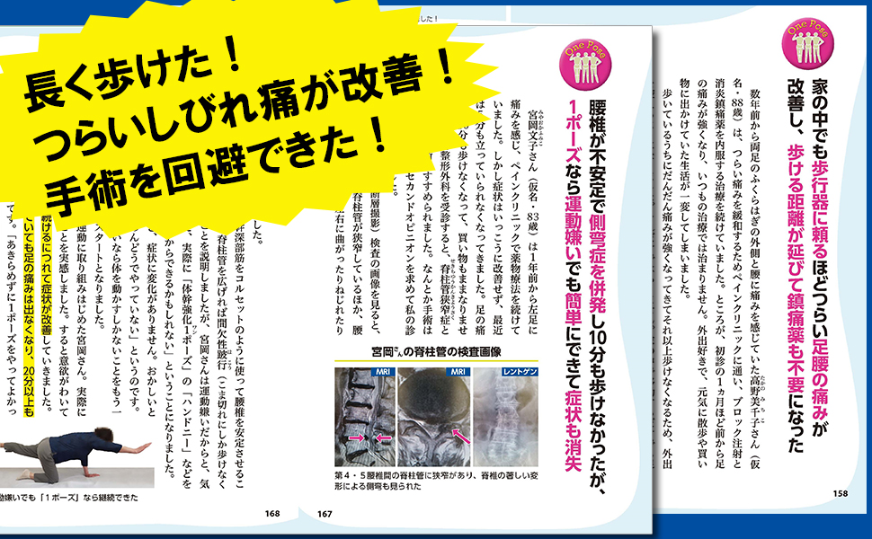 脊柱管狭窄症どんどんよくなる! 劇的1ポーズ大全
