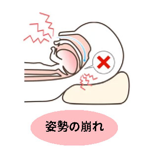 カルイビキ 睡眠時無呼吸症候群 無呼吸症候群 いびき Amazon.co.jp: カルイビキ 睡眠時無呼吸症候群 無効症候群