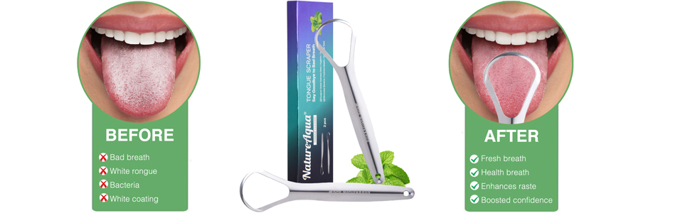 tongue scraper