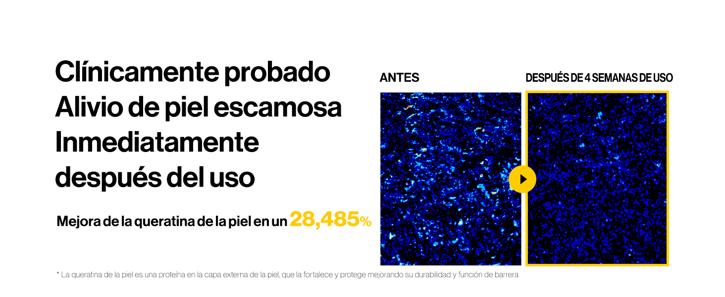 a protrusão do mundo