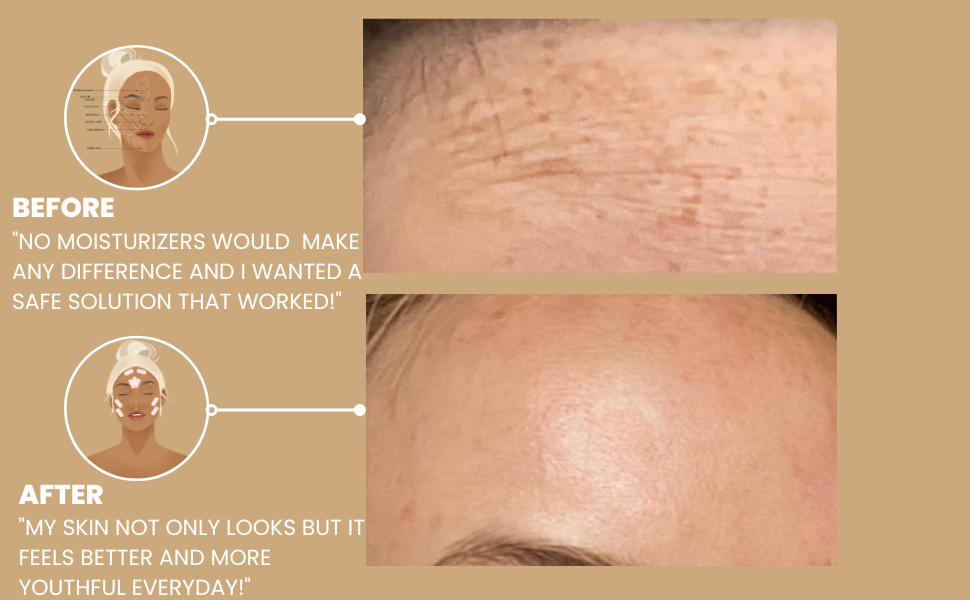 Skin Supervision Facial Tape for Wrinkles, Wrinkle Tape