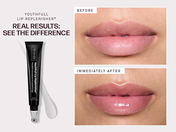 美容クリニック購入RevisionSkincare YouthFull Lip 5_18bd5d3c-9717-48d5-883a-