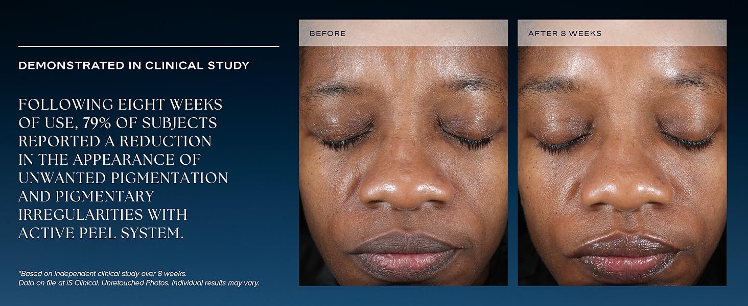 clinical study following 8 weeks of use 79% reported reduction in unwanted pigmentation 