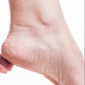 Arabica Coffee Body Scrub, Natural Body Scrubs for Women Exfoliation