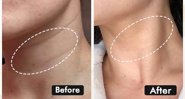 Upgrade LED Face Mask Red Light