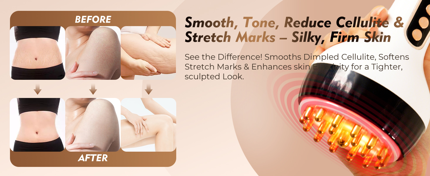 Anti-Cellulite Massager Before After